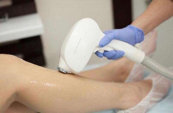 Студия лазерной эпиляции